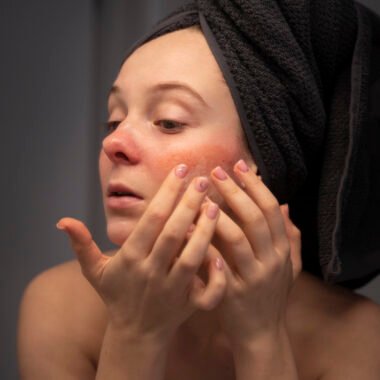 Soins anti-rougeurs et peau sensible