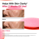 ANUA Niacinamide 10% + TXA 4% Serum 30ml